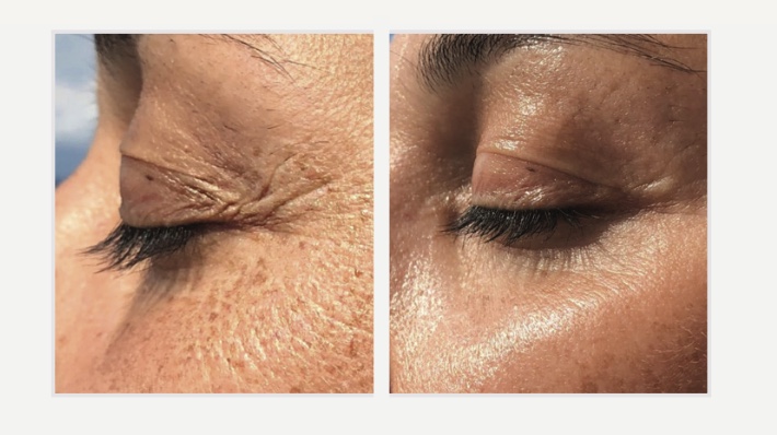 До і після застосування C.S.M. Eye Mask Extra Enriched — зона навколо очей